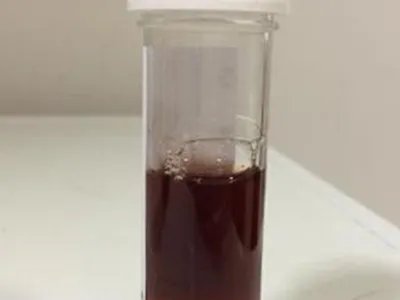 蚕豆病症状图片