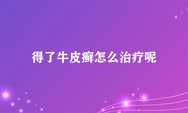 得了牛皮癣怎么治疗呢