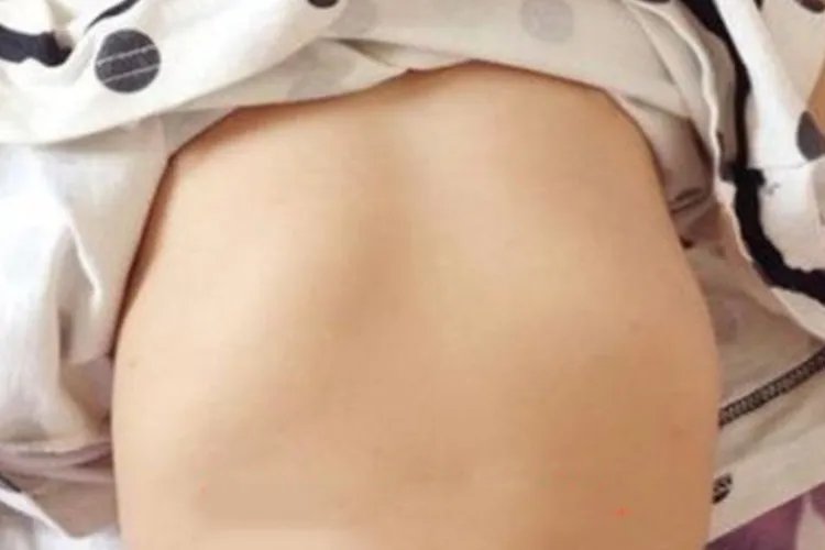 女孩鸡胸图片