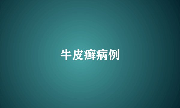 牛皮癣病例