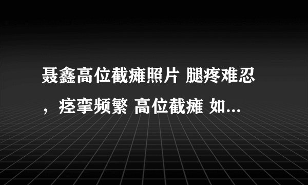 聂鑫高位截瘫照片 腿疼难忍，痉挛频繁 高位截瘫 如何解除高位截瘫后腿痛和痉挛？