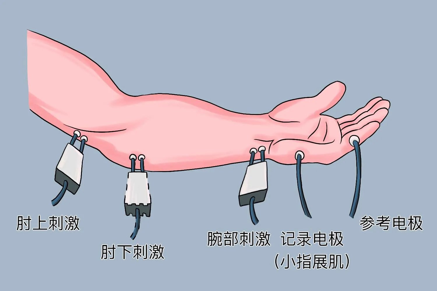 肌电图怎么做