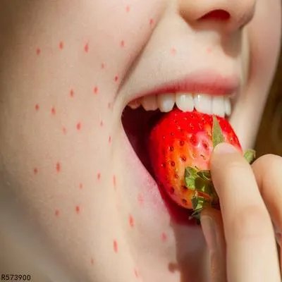 身上起红点不痛不痒怎么办