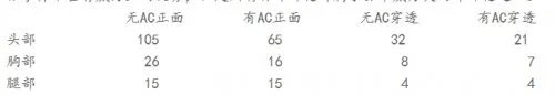 穿越火线二战元勋系列 古老的斯特林冲锋枪