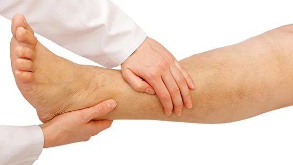 女性腿肿是什么原因