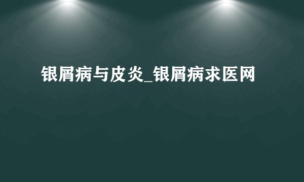 银屑病与皮炎_银屑病求医网