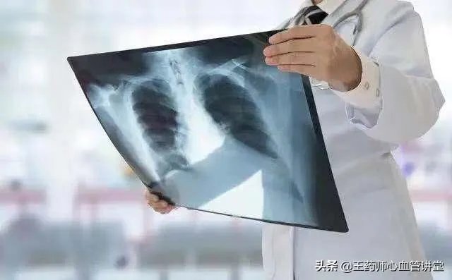 为什么有些年轻的医生感染新冠后去世了,而很多年纪大的患者却能够康复?