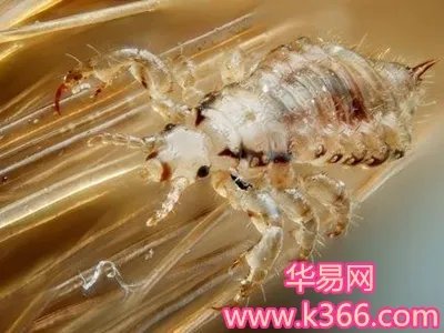 梦见虱子