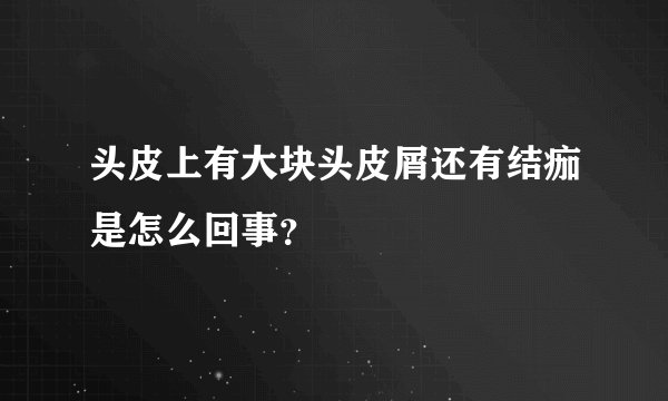头皮上有大块头皮屑还有结痂是怎么回事？