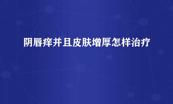 阴唇痒并且皮肤增厚怎样治疗