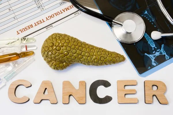 乔布斯死于的是胰岛细胞瘤 专家解析与胰腺癌区别