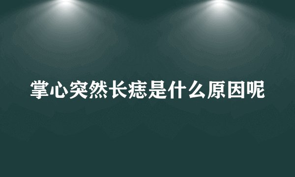 掌心突然长痣是什么原因呢
