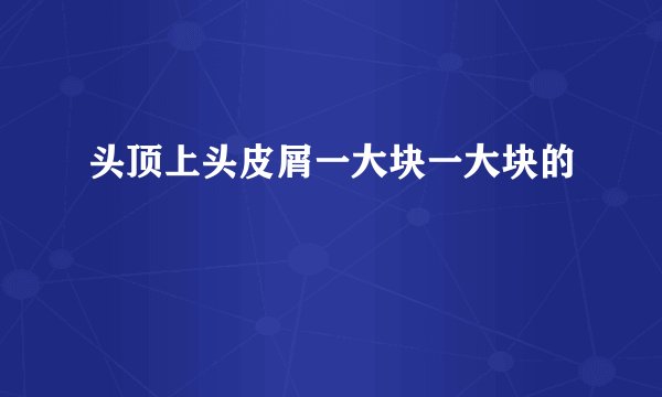 头顶上头皮屑一大块一大块的