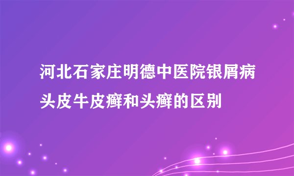 河北石家庄明德中医院银屑病头皮牛皮癣和头癣的区别