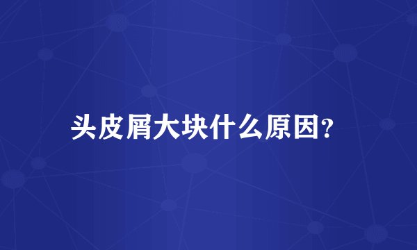 头皮屑大块什么原因？