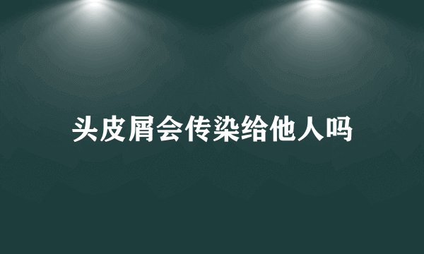 头皮屑会传染给他人吗