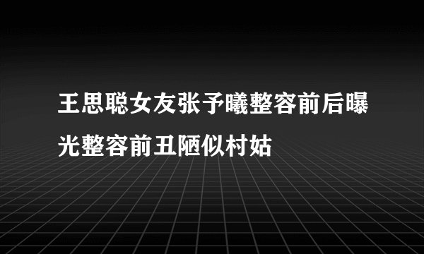 王思聪女友张予曦整容前后曝光整容前丑陋似村姑