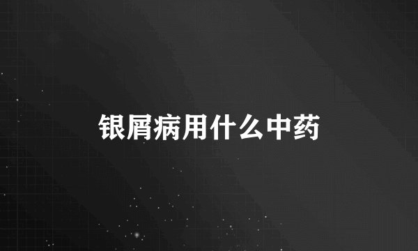 银屑病用什么中药