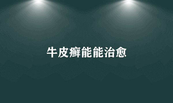 牛皮癣能能治愈