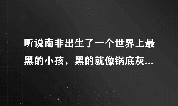 听说南非出生了一个世界上最黑的小孩,黑的就像锅底灰一样,是真的吗?