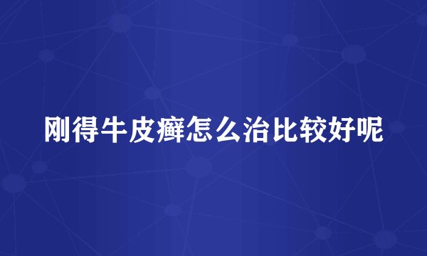刚得牛皮癣怎么治比较好呢