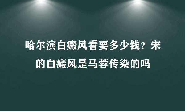 哈尔滨白癜风看要多少钱?宋喆的白癜风是马蓉传染的吗