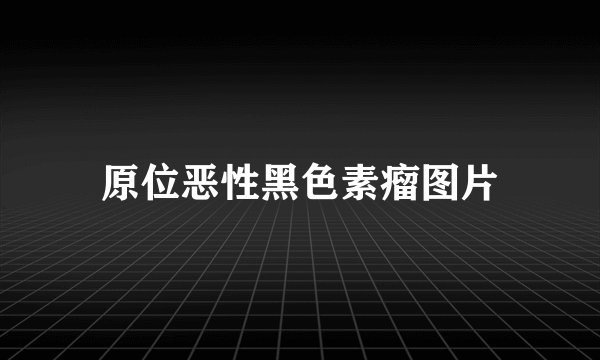 原位恶性黑色素瘤图片