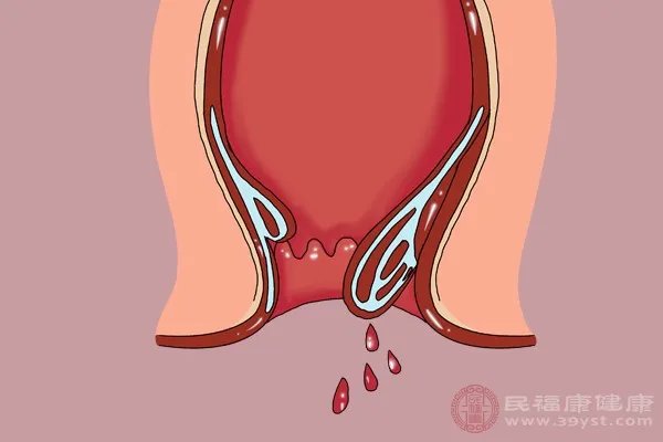 拉血是怎么回事