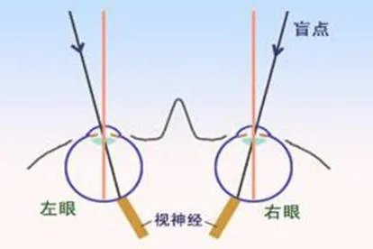 左眼盲点的位置靠近哪一侧
