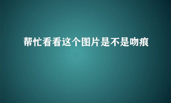 帮忙看看这个图片是不是吻痕