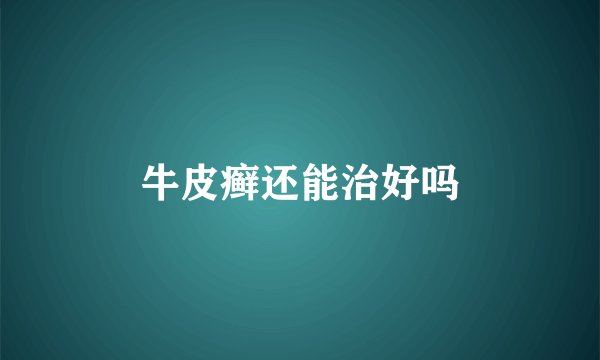 牛皮癣还能治好吗