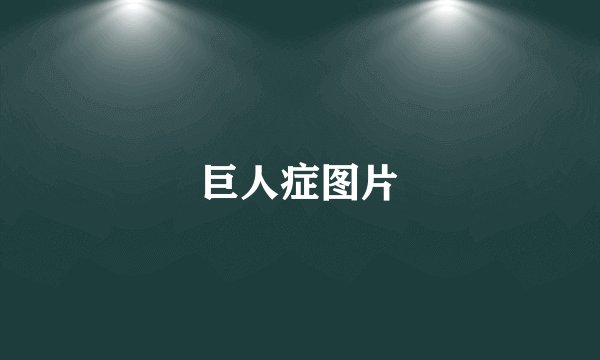 巨人症图片