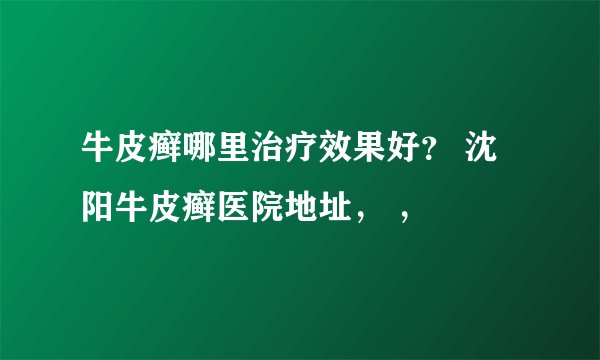 牛皮癣哪里治疗效果好？ 沈阳牛皮癣医院地址， ，