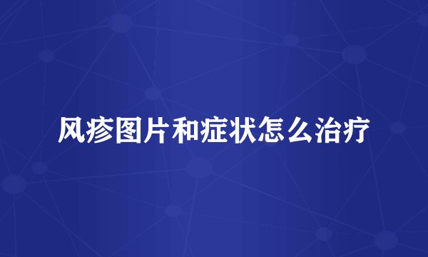 风疹图片和症状怎么治疗