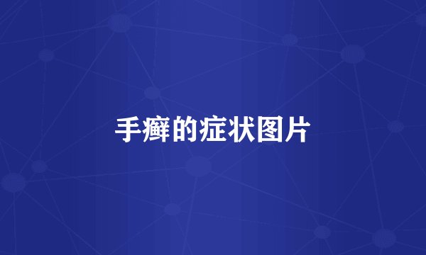 手癣的症状图片
