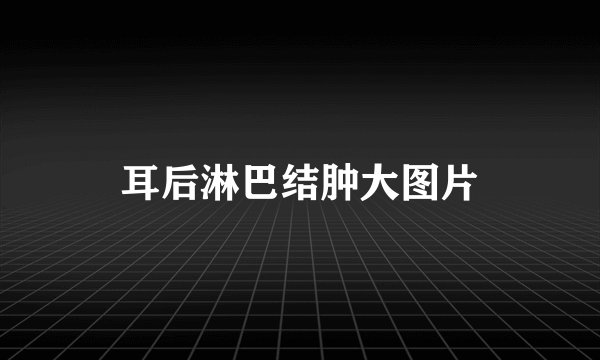 耳后淋巴结肿大图片