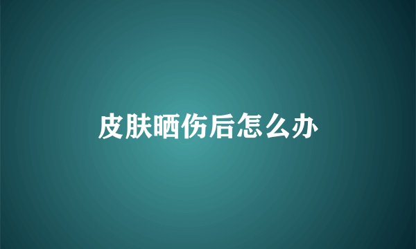 皮肤晒伤后怎么办