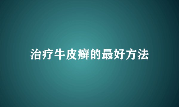 治疗牛皮癣的最好方法
