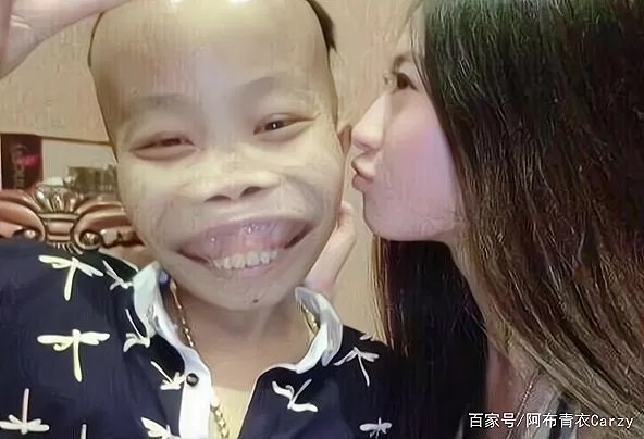 还记得“外星人”陈山吗?被封杀3年之后变化巨大,现在如何了?