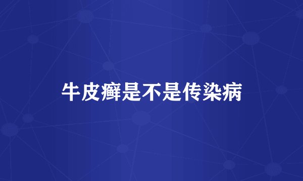 牛皮癣是不是传染病