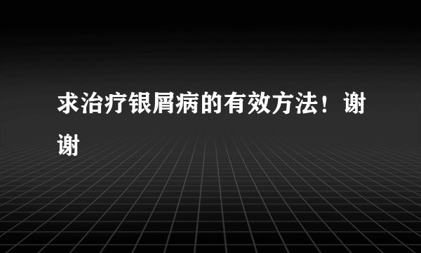 求治疗银屑病的有效方法！谢谢