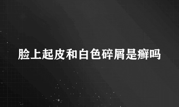 脸上起皮和白色碎屑是癣吗